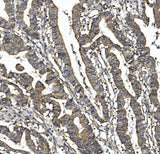 Anti-SORBS1 Picoband® Antibody Boster Bio