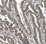 Anti-SORBS1 Picoband® Antibody Boster Bio