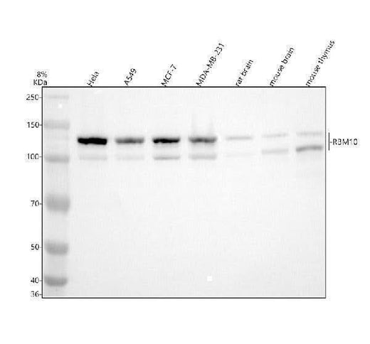 Anti-RBM10 Antibody Picoband® Boster Bio