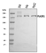 Anti-PLA2R/PLA2R1 Antibody Picoband® Boster Bio