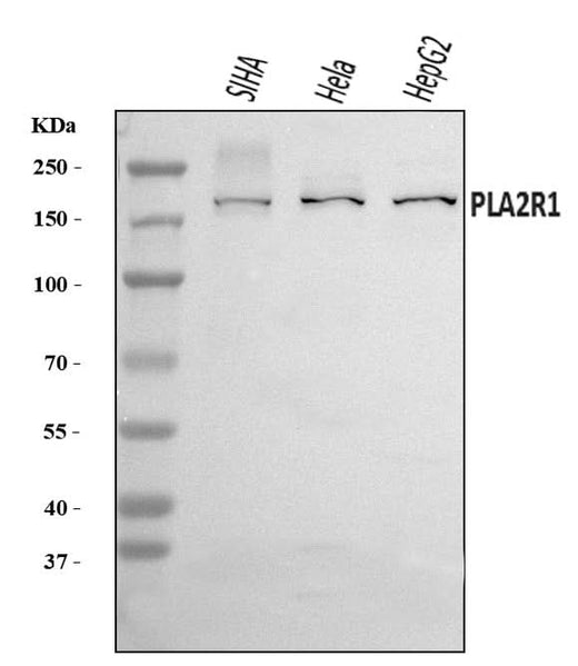 Anti-PLA2R/PLA2R1 Antibody Picoband® Boster Bio