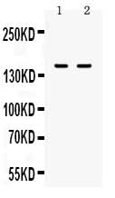 Anti-CD11a/ITGAL Antibody Picoband® Boster Bio