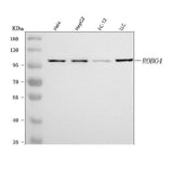 Anti-ROBO4 Antibody Picoband® Boster Bio