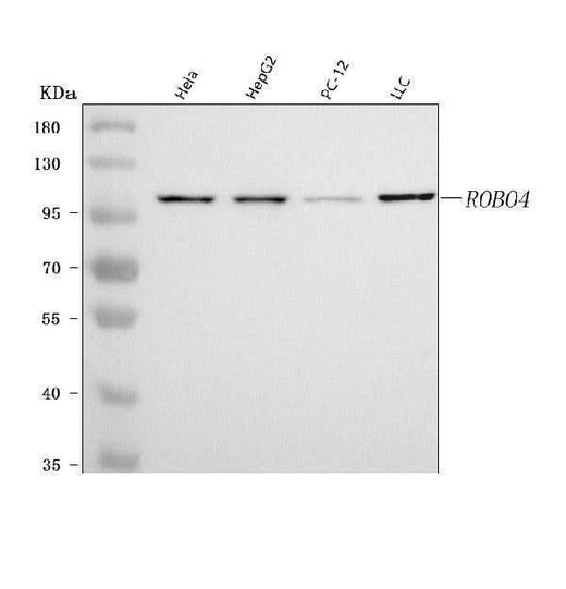 Anti-ROBO4 Antibody Picoband® Boster Bio