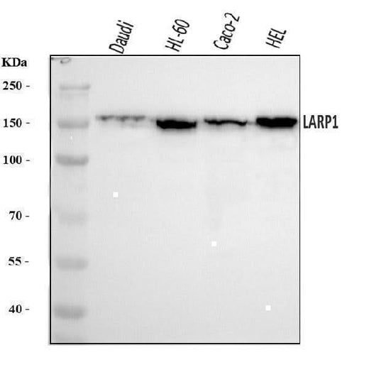 Anti-LARP1 Antibody Picoband® Boster Bio