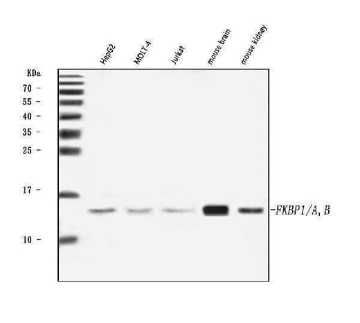 Anti-FKBP1A/1B Antibody Picoband® Boster Bio