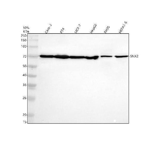 Anti-SNX2 Antibody Picoband® Boster Bio