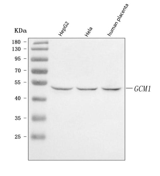 Anti-GCM1 Antibody Picoband® Boster Bio