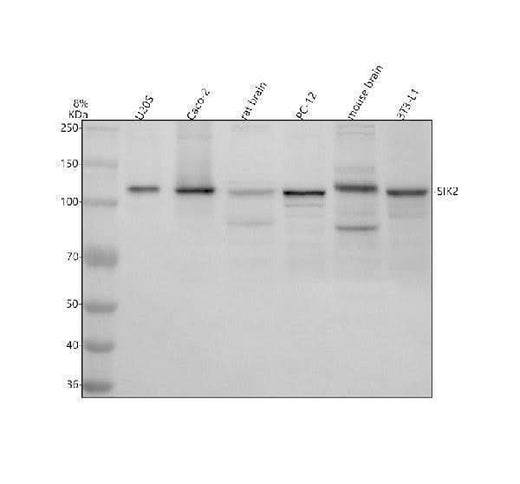 Anti-SIK2 Antibody Picoband® Boster Bio