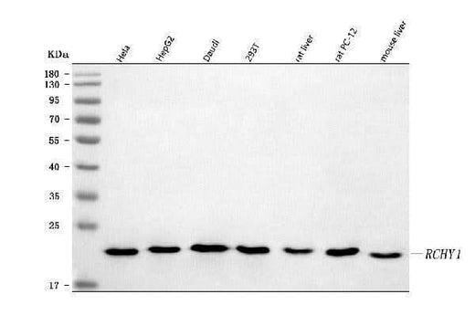 Anti-Pirh2/RCHY1 Antibody Picoband® Boster Bio