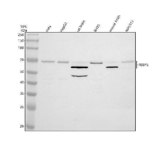 Anti-RBBP5 Antibody Picoband® Boster Bio
