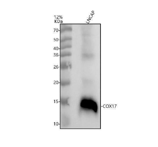 Anti-DNAJA4 Antibody Picoband® Boster Bio