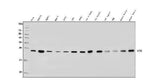 Anti-RAB1B Antibody Picoband® Boster Bio