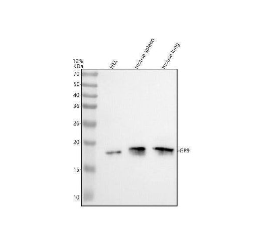 Anti-CD42a/GP9 Antibody Picoband® Boster Bio