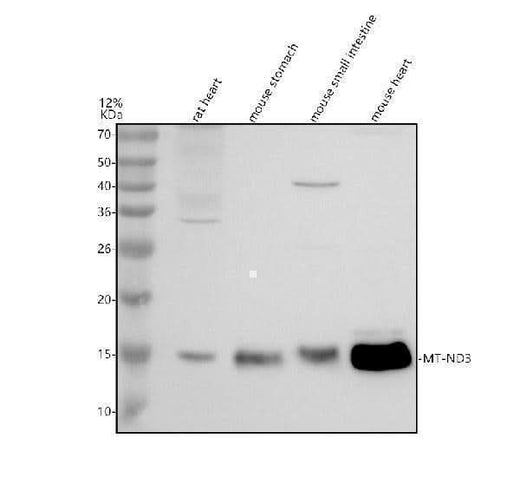 Anti-ND3/MT-ND3 Antibody Picoband® Boster Bio