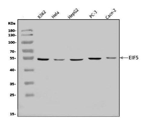 Anti-EIF5 Antibody Picoband® Boster Bio