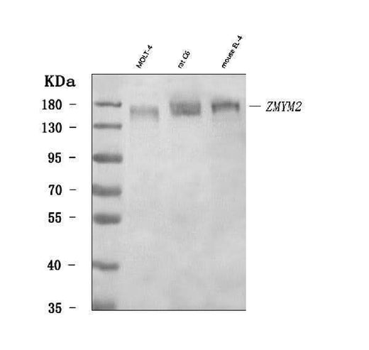 Anti-RAMP/ZMYM2 Antibody Picoband® Boster Bio