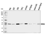 Anti-CSNK2A2 Antibody Picoband® Boster Bio