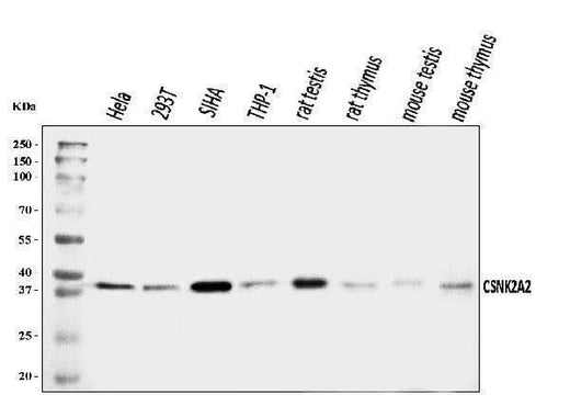 Anti-CSNK2A2 Antibody Picoband® Boster Bio