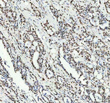 Anti-NKX2-2 Antibody Boster Bio