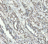 Anti-NKX2-2 Antibody Boster Bio