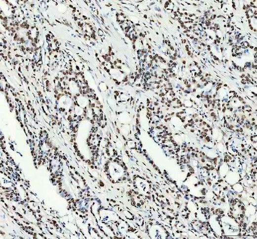 Anti-NKX2-2 Antibody Boster Bio