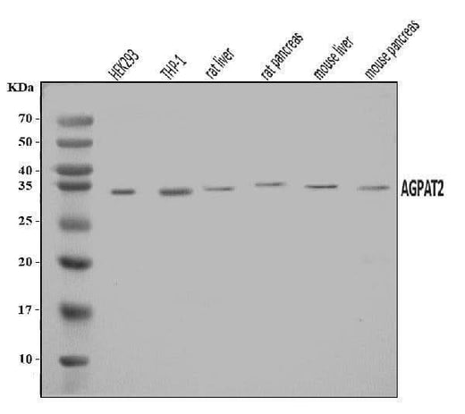 Anti-AGPAT2 Antibody Picoband® Boster Bio