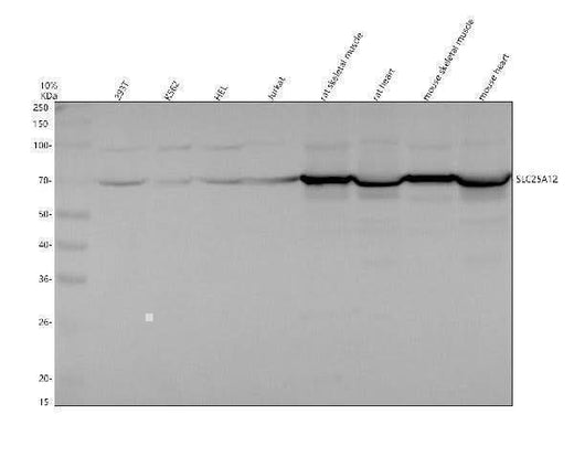Anti-SLC25A12 Antibody Picoband® Boster Bio