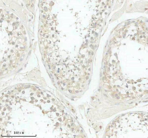 Anti-SLC29A3 Antibody Boster Bio