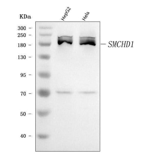 Anti-SMCHD1 Antibody Picoband® Boster Bio