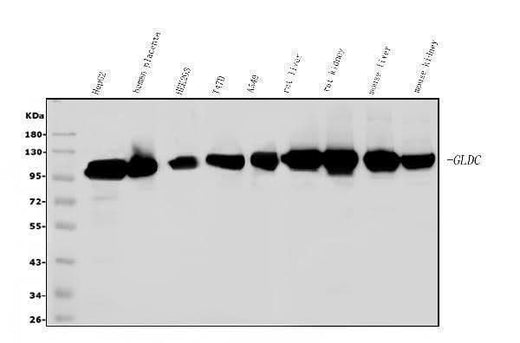 Anti-Glycine decarboxylase/GLDC Antibody Picoband® Boster Bio