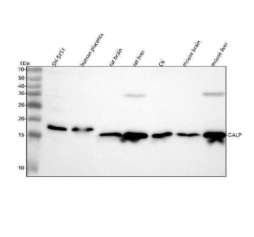 Anti-GALP Antibody Picoband® Boster Bio