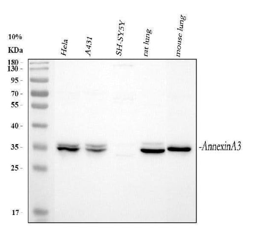 Anti-Annexin A3/ANXA3 Antibody Picoband® Boster Bio