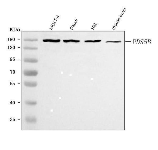 Anti-PDS5B Antibody Picoband® Boster Bio