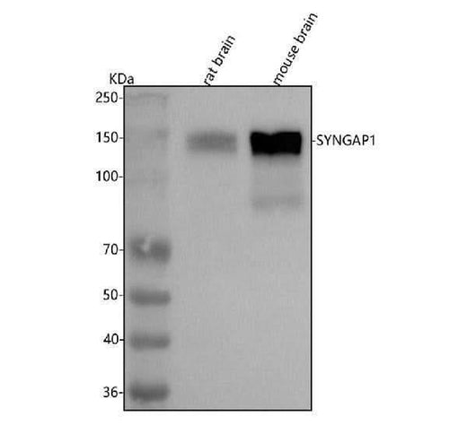 Anti-SYNGAP1 Antibody Picoband® Boster Bio