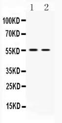Anti-Vesicular Acetylcholine Transporter/SLC18A3 Antibody Picoband® Boster Bio