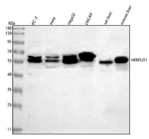 Anti-HERP/HERPUD1 Antibody Picoband® Boster Bio