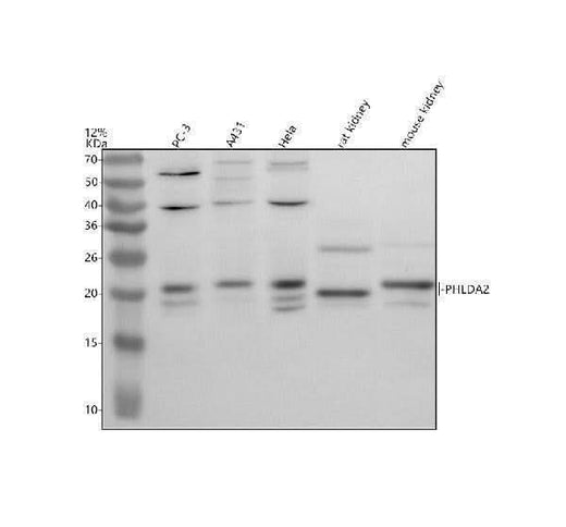 Anti-PHLDA2 Antibody Picoband® Boster Bio