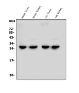 Anti-LOC134147/CMBL Antibody Picoband® Boster Bio