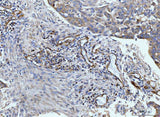 Anti-CD93 Antibody Boster Bio