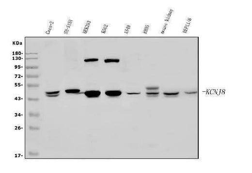 Anti-Kir6.1/KCNJ8 Antibody Picoband® Boster Bio