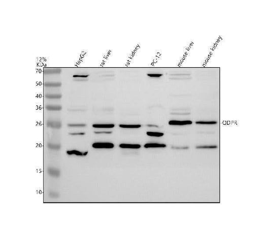 Anti-QDPR Antibody Picoband® Boster Bio