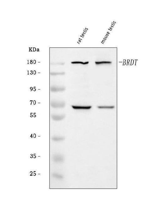 Anti-BRDT Antibody Picoband® Boster Bio