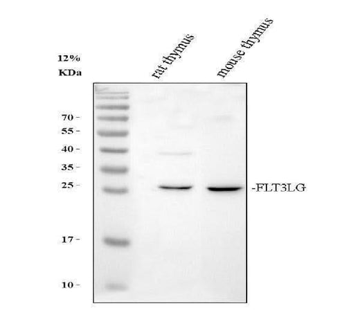 Anti-Flt3 ligand/Flt3lg Antibody Picoband® Boster Bio
