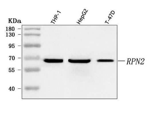 Anti-RPN2 Antibody Picoband® Boster Bio
