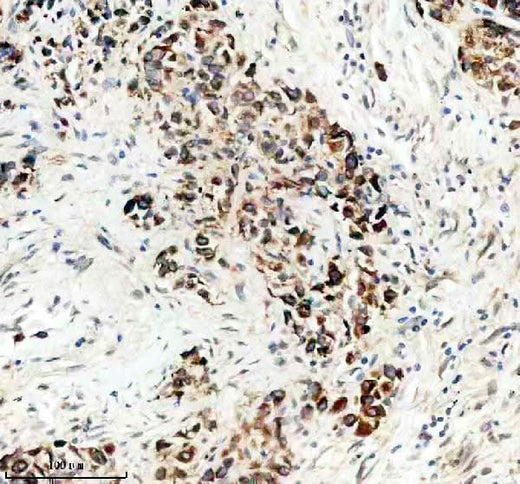 Anti-TCIRG1 Antibody Boster Bio