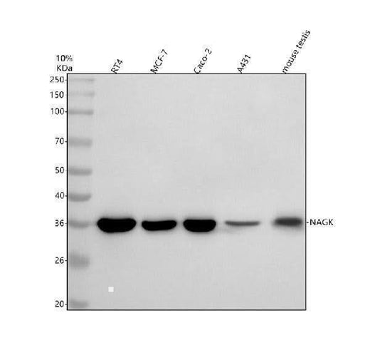 Anti-NAGK Antibody Picoband® Boster Bio