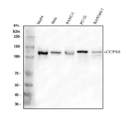 Anti-CP110/CCP110 Antibody Picoband® Boster Bio