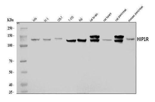 Anti-HIP1R Antibody Picoband® Boster Bio