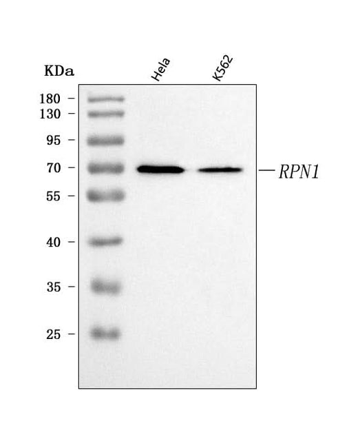 Anti-Ribophorin I/RPN1 Antibody Picoband® Boster Bio
